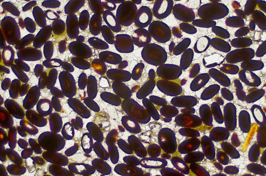 ZN 40556 Minerai de fer montrant des oolithe LPNA x10
